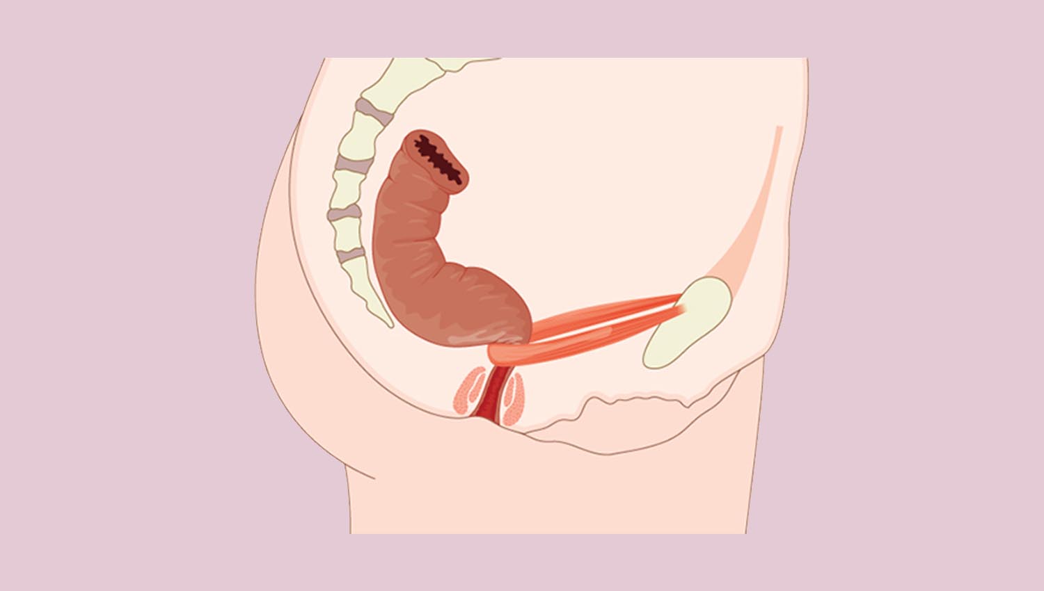 kistet-ne-vezore-trajtimi