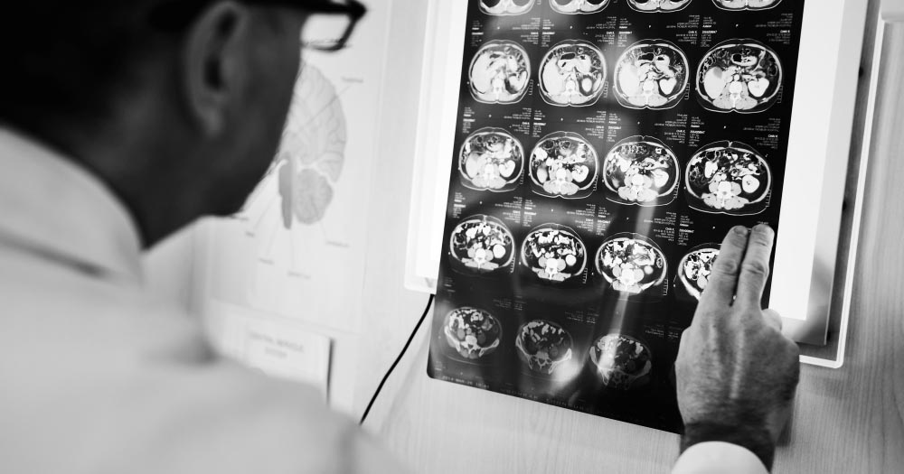 ekzaminim neurologjik