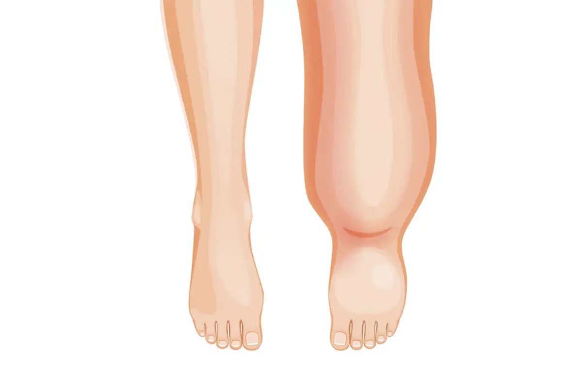 Cardiovascular Picture